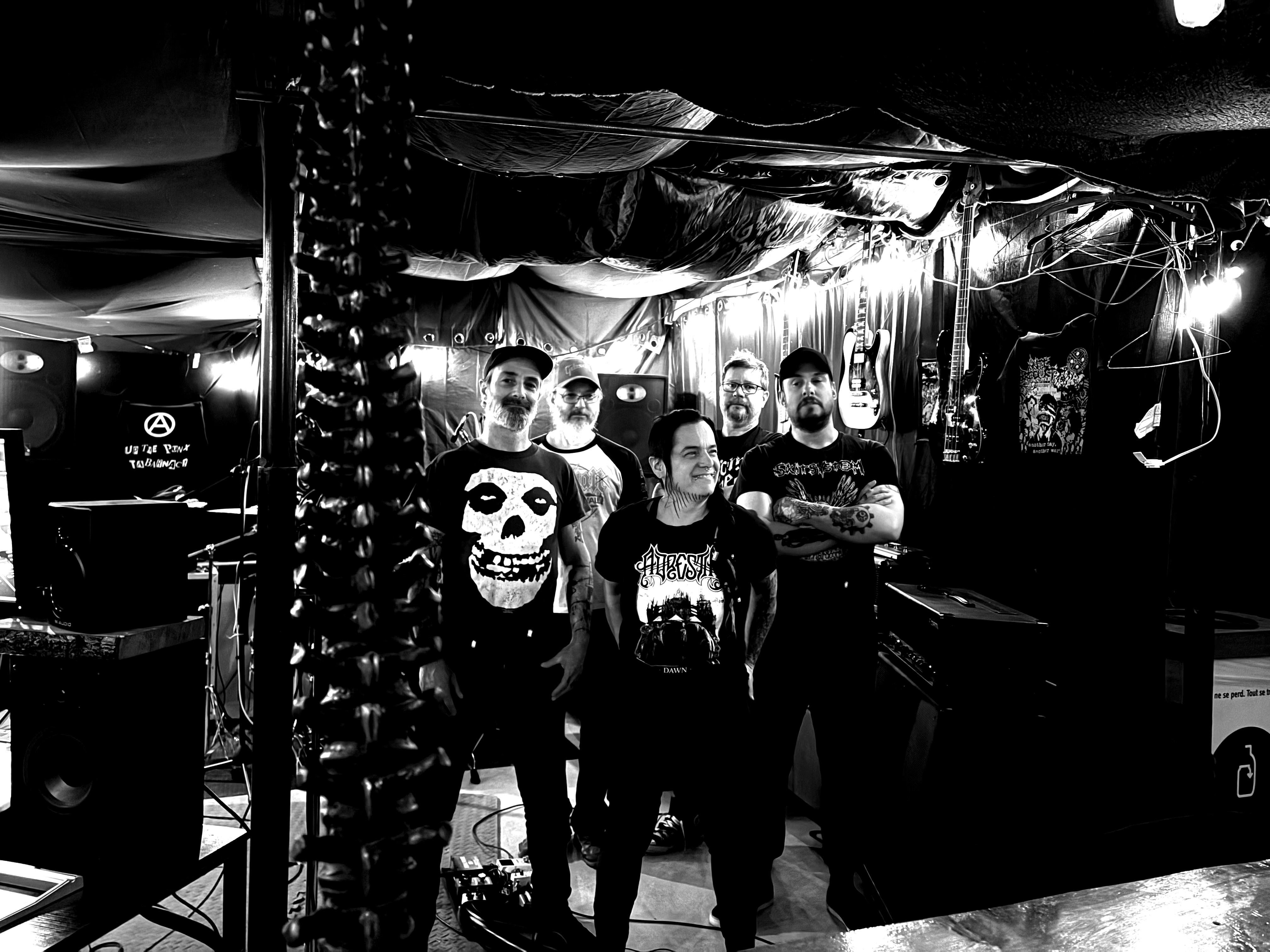 Injur band profile